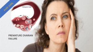 premature ovarian failure