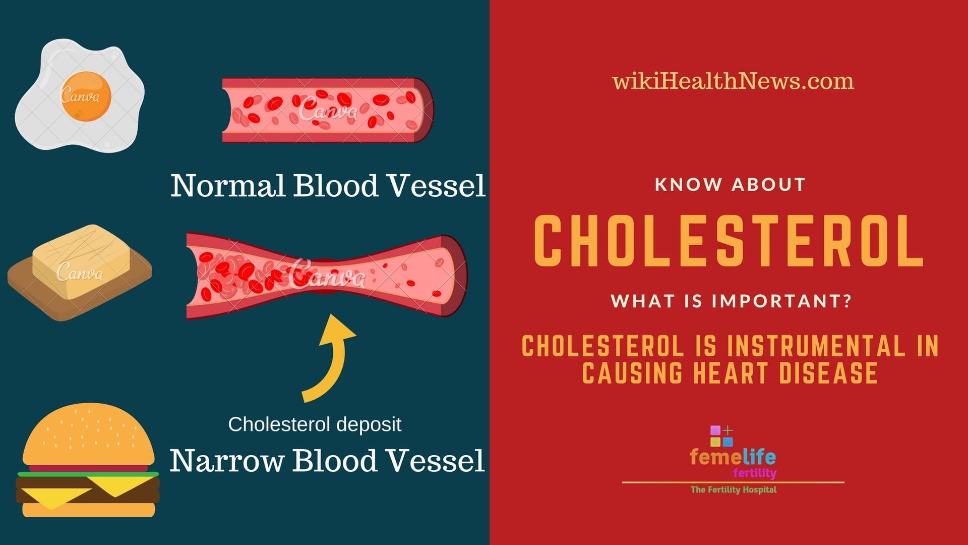 Cholesterol and Heart