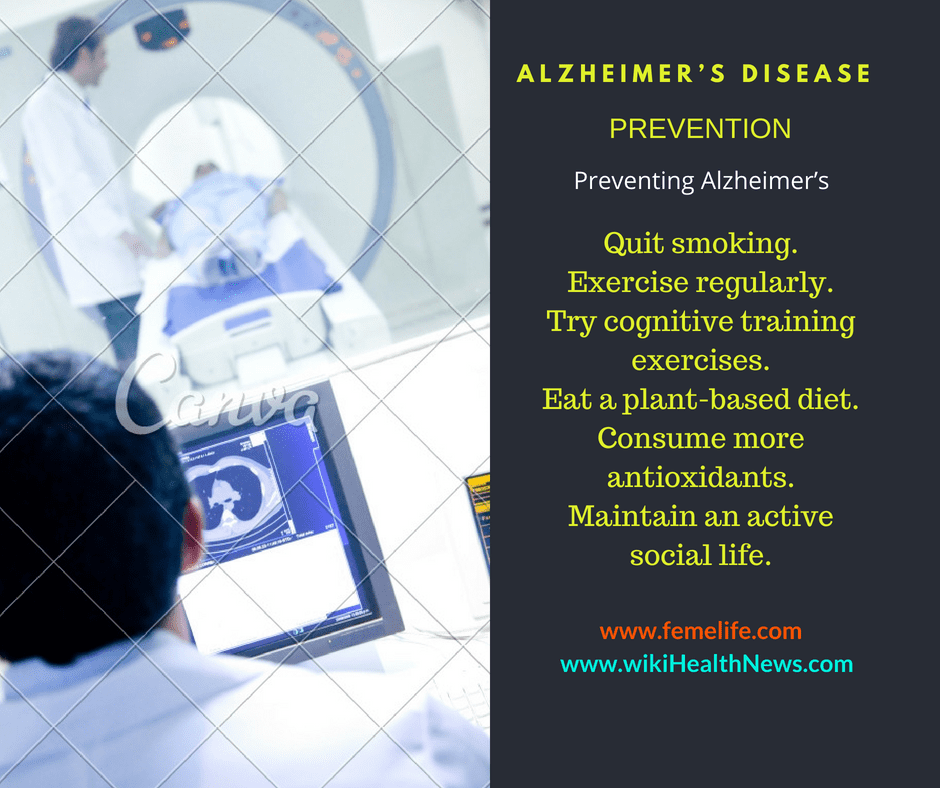 alzheimers disease