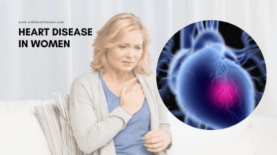 Heart disease in women