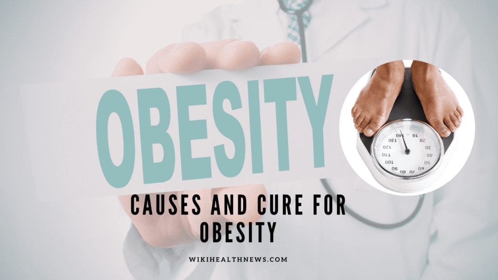 Causes of obesity