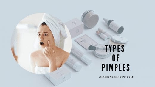 Types of Pimples