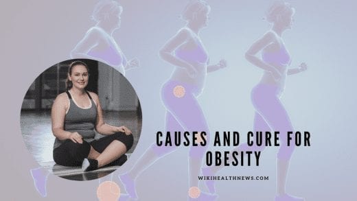 Causes of obesity