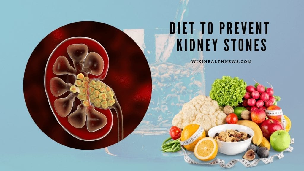 Kidney stone diet