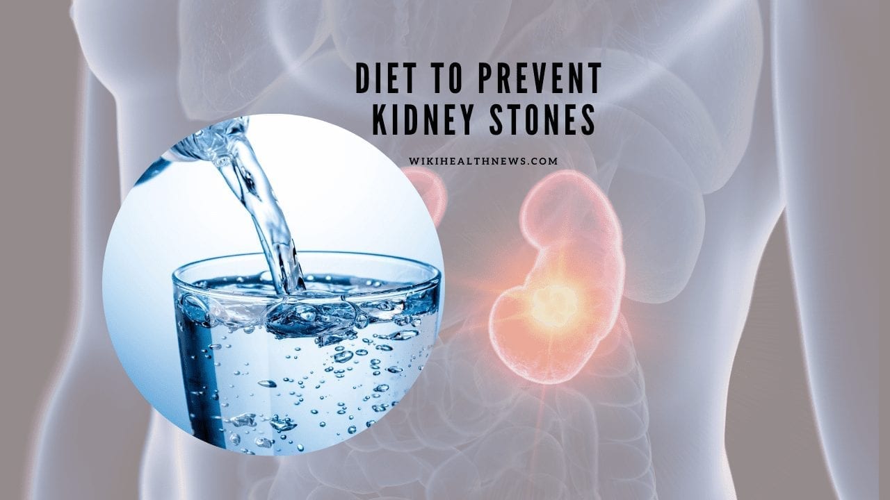 Kidney stone diet