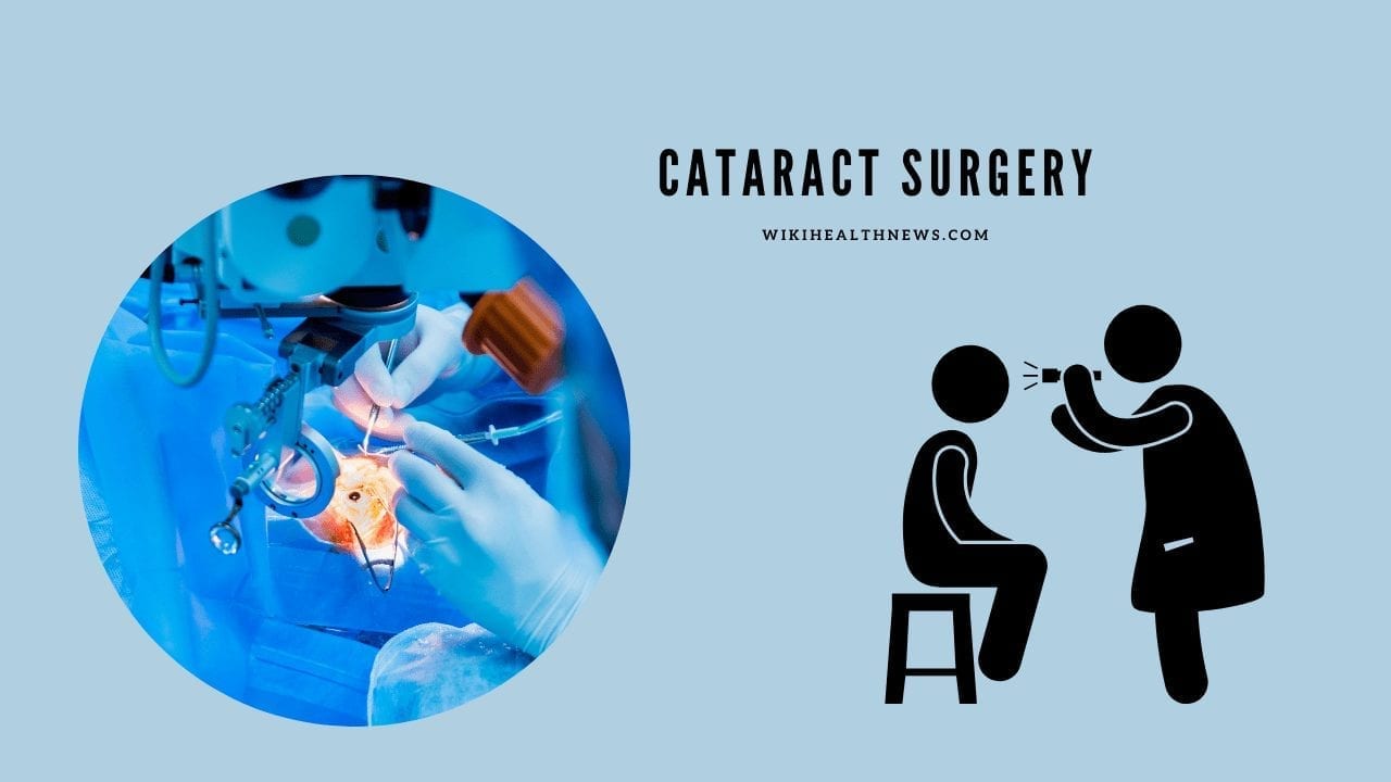 cataract surgery