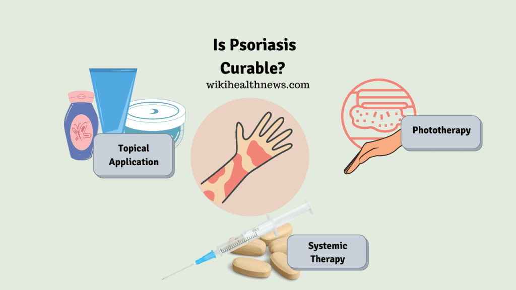 psoriasis