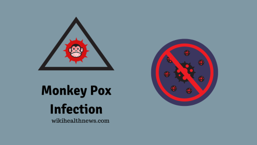 Monkey Pox Infection