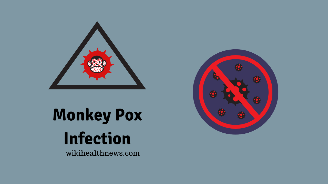 Monkey Pox Infection : Indications & Cure