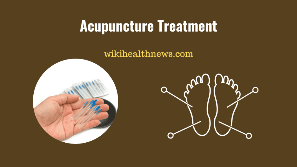 Acupuncture treatment