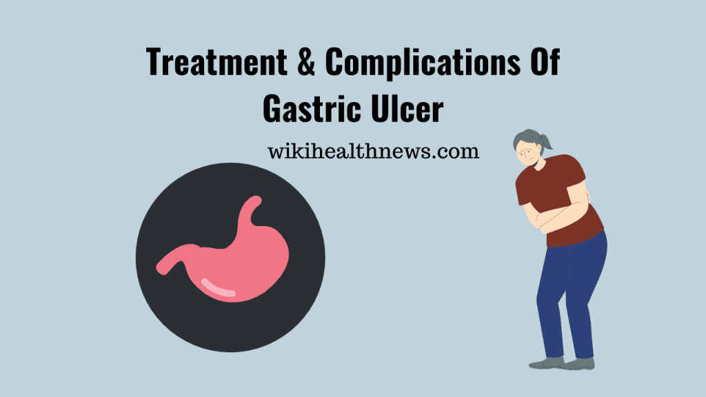 Gastric Ulcer