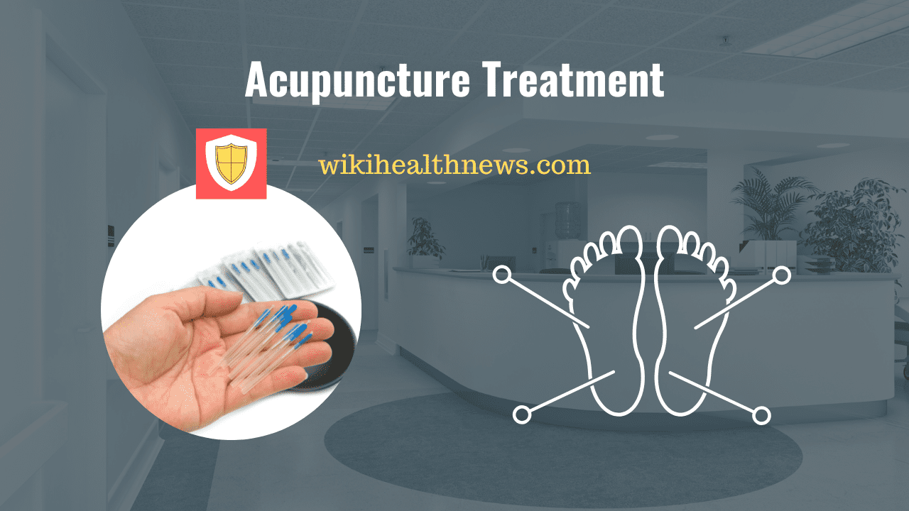 acupuncture