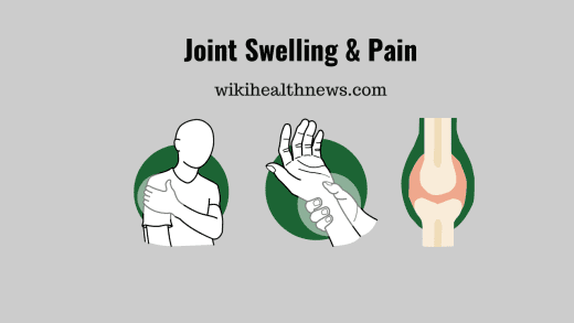 Joint Swelling