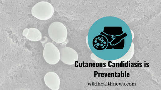 Cutaneous candidiasis