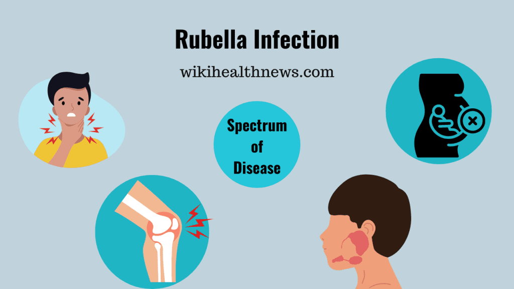 Rubella virus infection