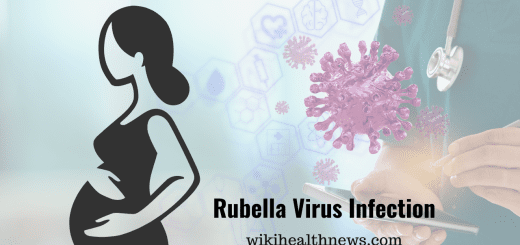 Rubella virus infection