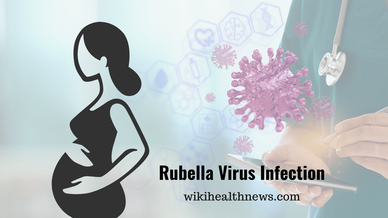Rubella virus infection