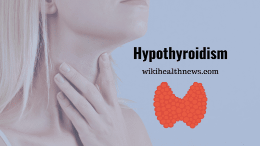 Hypothyroidism