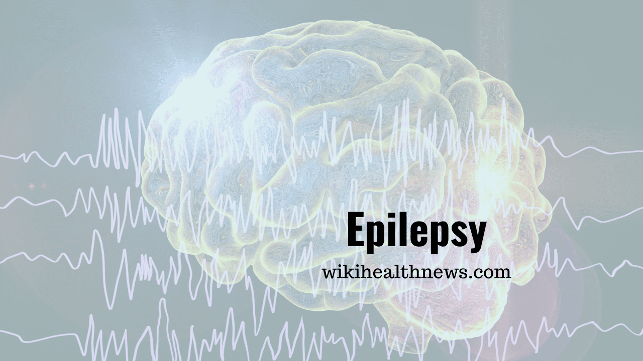 Epilepsy