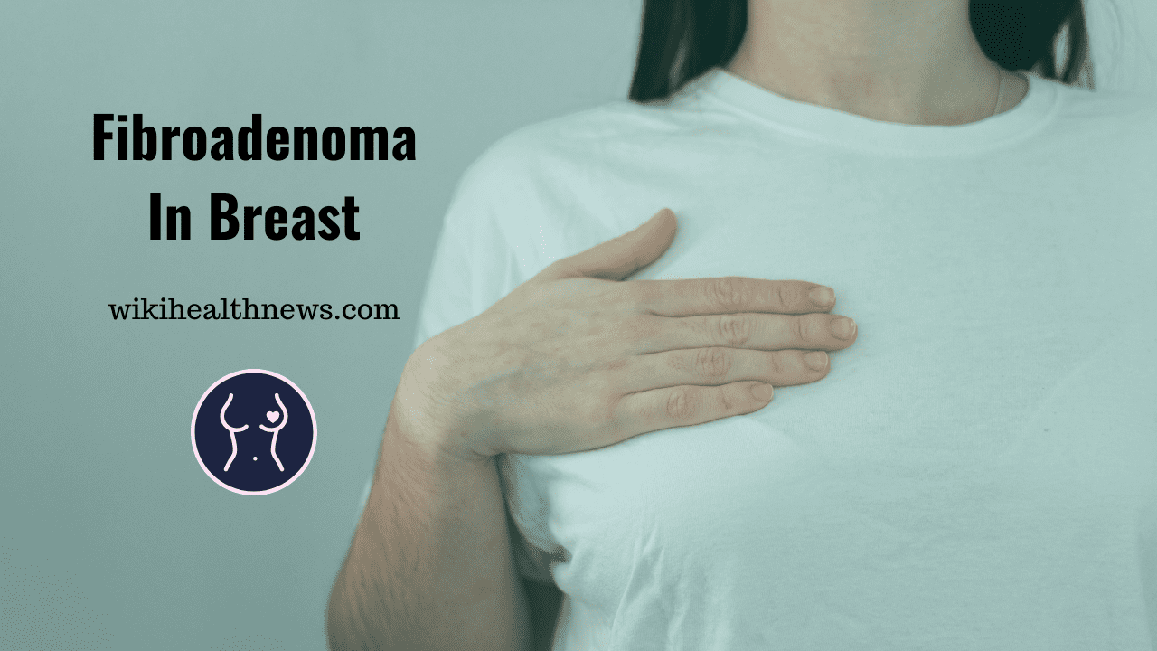 Fibroadenoma A Solid Lump In Breast Wiki Health News