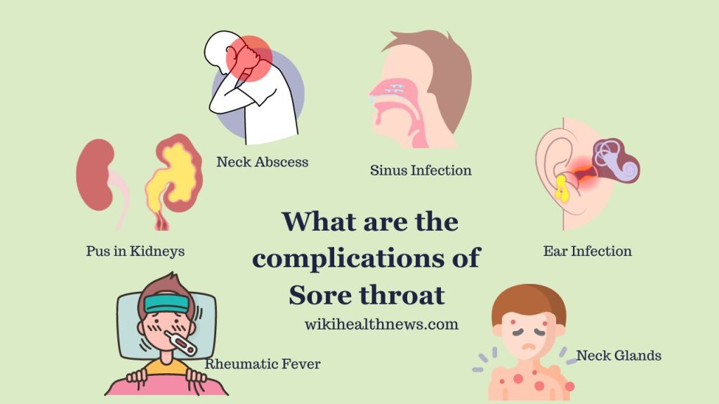 One of the most common complaints, sore throat, accounts for more than 2% of all adult primary care visits each year. 